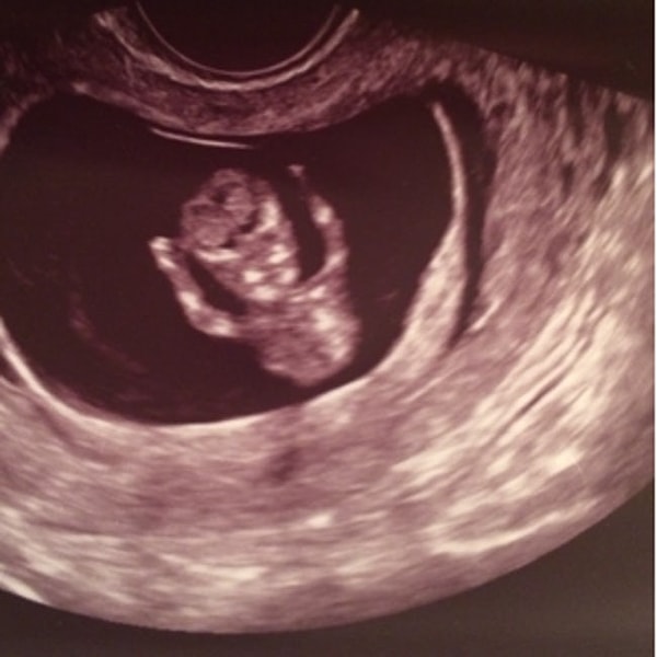 12. "Ну давай, нападай, братан!"