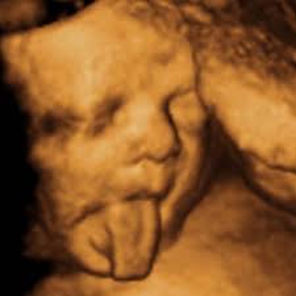 14. Косплеит Эйнштейна?