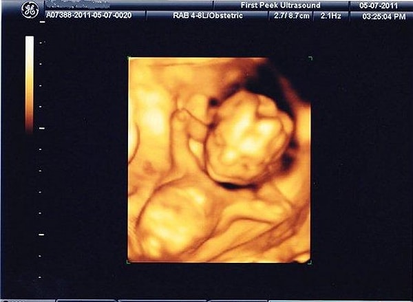 15. Расслабляйся, малыш, пока можешь...