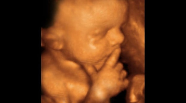 22. "Мммм, дай подумать... Нет!"