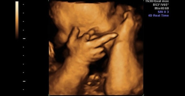 23. Когда ты потерпел настолько невероятное фиаско, что даже плод в твоем чреве фейспалмит.