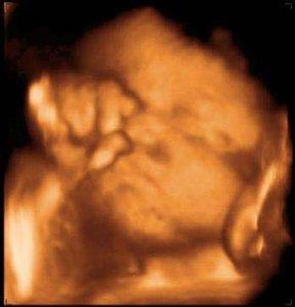 24. Маленькая Шурыгина подрастает.