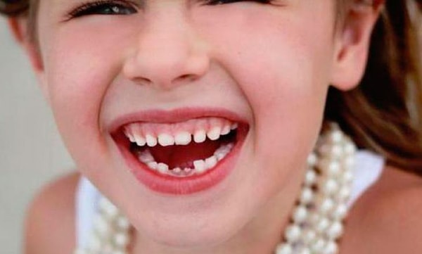 1) Молочных зубов может быть всего...