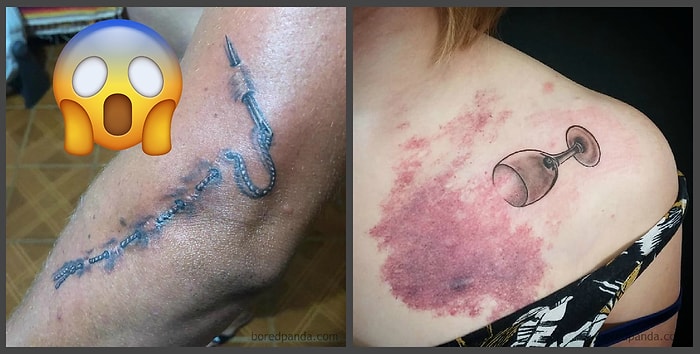 Берем на заметку: Как можно скрыть страшные шрамы при помощи тату