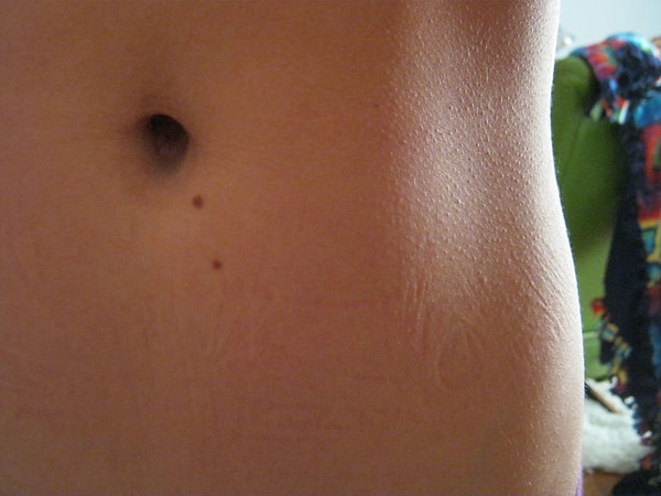 10. На животе