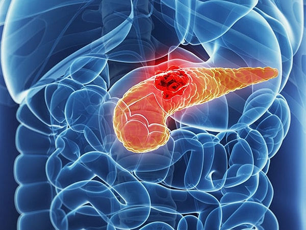 4. Поджелудочная железа выполняет сразу две важные работы. Во-первых, она помогает пищеварению, а во-вторых…