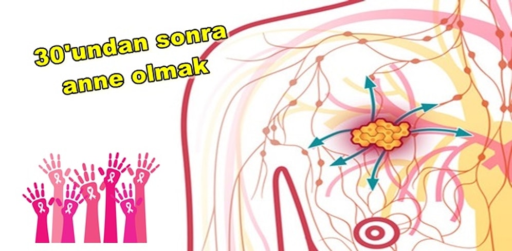 Meme Kanseri Belirtileri ve Tedavi Seçenekleri ile İlgili En Çok Merak Edilenler