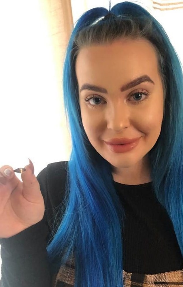 Abigail Thompson'ın 12 yıl önce kaybettiği yüzüğü, hapşırdıktan sonra burnundan çıktı.
