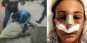 Evleneceği Kadına Arkadaşlarıyla 'Kız Kaçırma' Şakası Yaparken, Kadının Burnunu Kıran Damat!