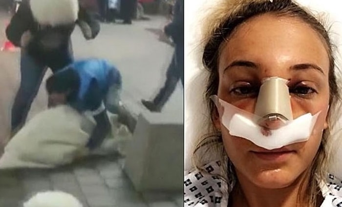 Evleneceği Kadına Arkadaşlarıyla 'Kız Kaçırma' Şakası Yaparken, Kadının Burnunu Kıran Damat!