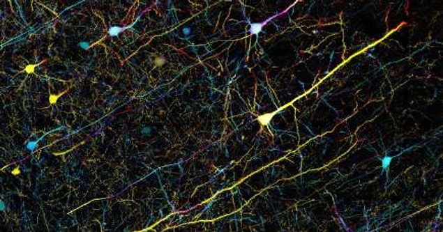 7. Peki bahsi geçen epilepsi nöbeti türleri nelerdir?