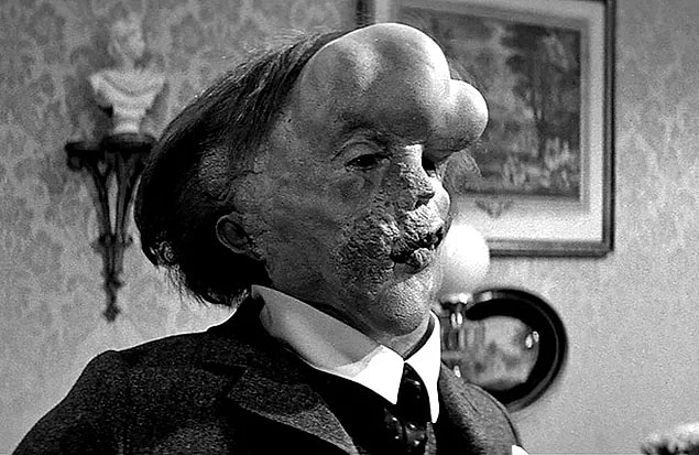 5. Fil Adam (1980) The Elephant Man