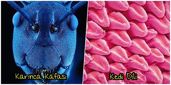 Mikroskop Altındaki Görüntüsüyle Beyinlerimizi Yakan 18 Sıradan Şey