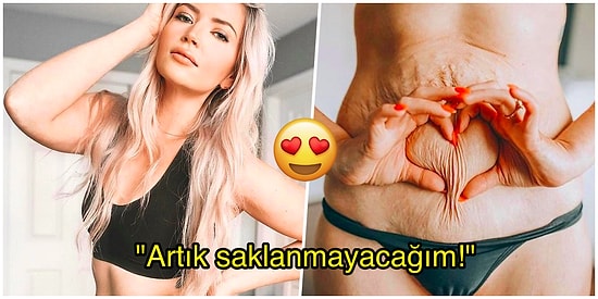 "Tartı Beni Sayılara Hapsediyordu!" Vücudundaki Selülitleriyle ve Çatlaklarıyla Gurur Duyan 3 Çocuk Annesi Kadın