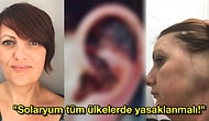 Her Şey Güzellik İçin! Bronz Ten Uğruna Yıllardır Gittiği Solaryum Yüzünden Kulağı Kesilen Kadın