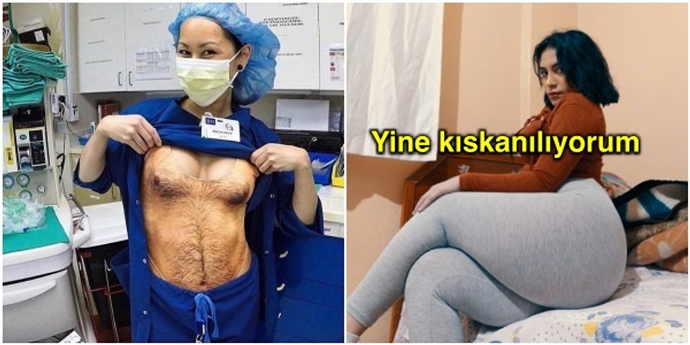 Gördüğünüz Andan İtibaren Saçınızı Başınızı Yoldurup Gençliğinizi Solduracak Acayip Görseller