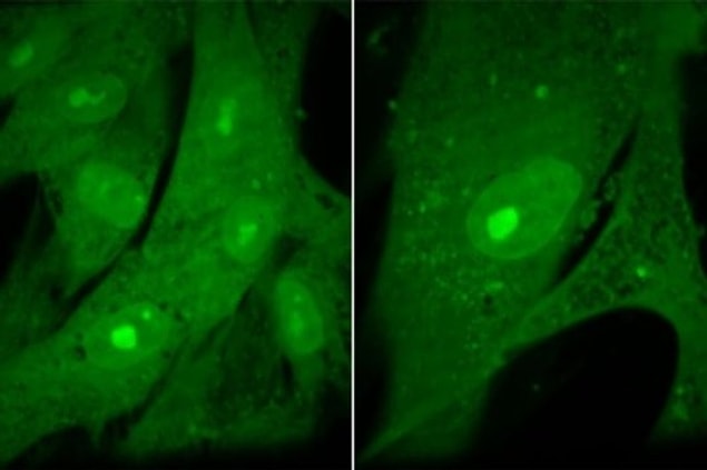 Hücre durumunda ortaya çıkan bu protein eksikliğinin, hücrenin yaşlanması ve bölünmemesi durumuna yol açtığı sonucuna varıldı.