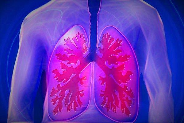 13. Kronik Obstrüktif Pulmoner Hastalığı