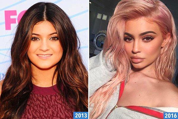 11. Kylie Jenner'ın da değişiminin sadece estetik kaynaklı olmadığı iddiası ortaya atıldı.