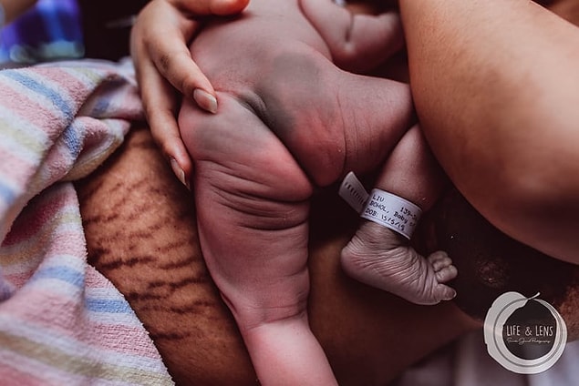 18. Birth marks on its little resident: " Birth Leaves Its Mark on Us All" by Sarah Widnyana