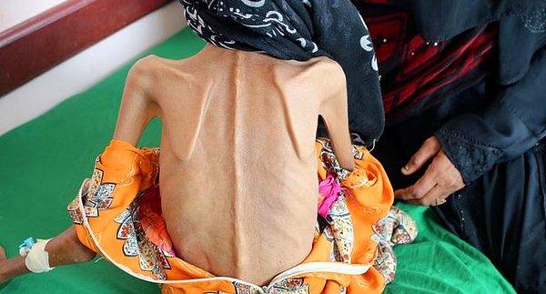 Fatima ve 10 kardeşi, Yemen'deki savaşın şiddetlenmesi üzerine evlerini terk etmek zorunda kalmış