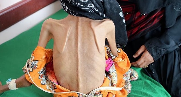 Fatima ve 10 kardeşi, Yemen'deki savaşın şiddetlenmesi üzerine evlerini terk etmek zorunda kalmış