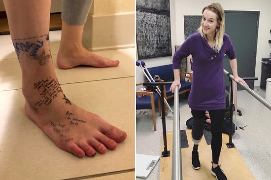 Kesilecek Ayağına Trajikomik Bir Ayrılık Notu Yazarak Veda Eden Kadın!