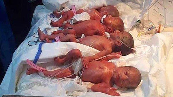 Sıra dışı doğumun ardından annenin ve yapılan birçok kontrolün ardından 7 bebeğin (6'sı kız 1'i erkek) oldukça sağlıklı olduğu bilgisi verildi.
