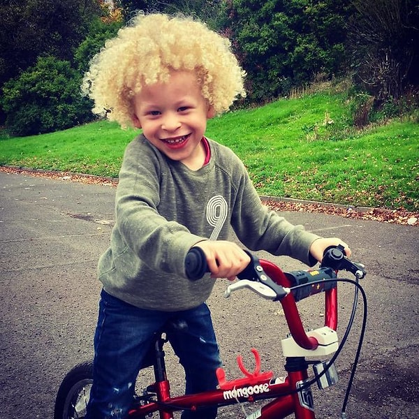 4. Ребенок чувствовал свою непохожесть на других детей