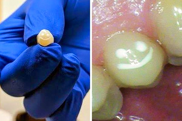 19. "Diş doktorumdan yaptığı kaplamayı biraz daha az sıkıcı hale getirmesini rica ettim."