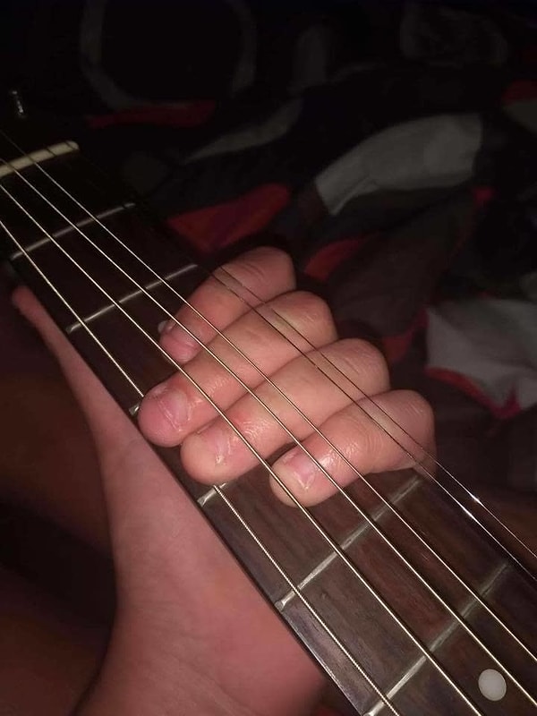 2. Хм… Это же наверняка очень больно!