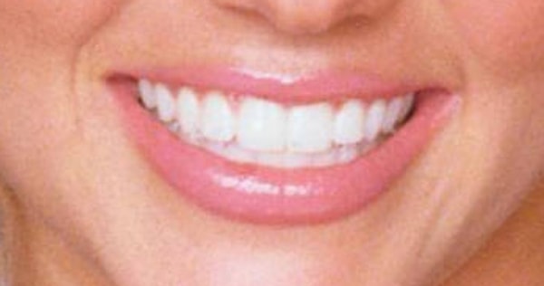 3. Эти зубы принадлежат...