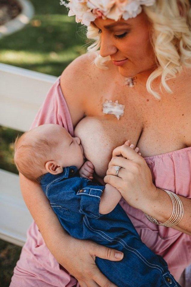 Kanser tedavisinden aylar sonra Nikki bebeğini kendisi emzirebilir hale geldi. Bu duygusal an, başka annelerin de sütlerini bağışlaması konusunda teşvik etmek için paylaşıldı.