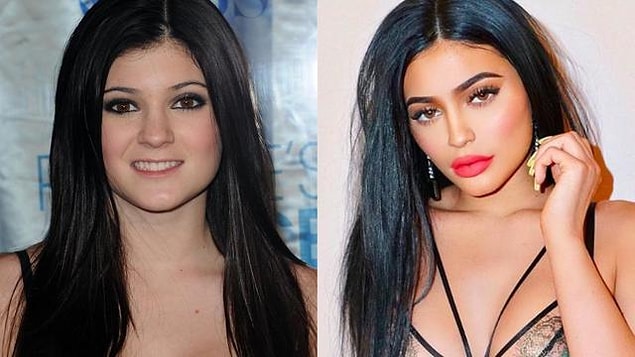1. Kylie Jenner estetiği olmadığına dair yemin bile etti geçtiğimiz günlerde...