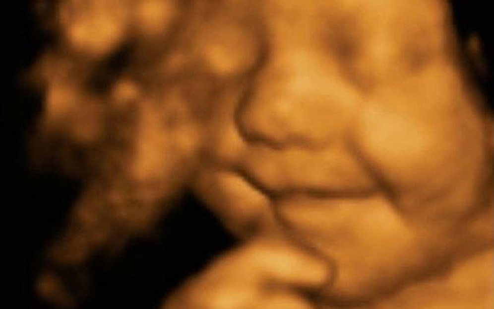 4 Boyutlu Tarayıcı ile Görüntülenen Anne Karnındaki Bebeğin Muhteşem Anları