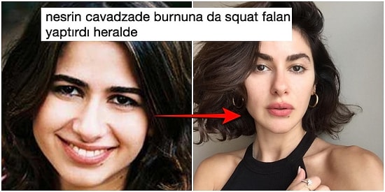 'Estetiğim Yok, Glutensiz Besleniyorum' Diyen Nesrin Cavadzade Goygoycuların Eline Fena Düştü