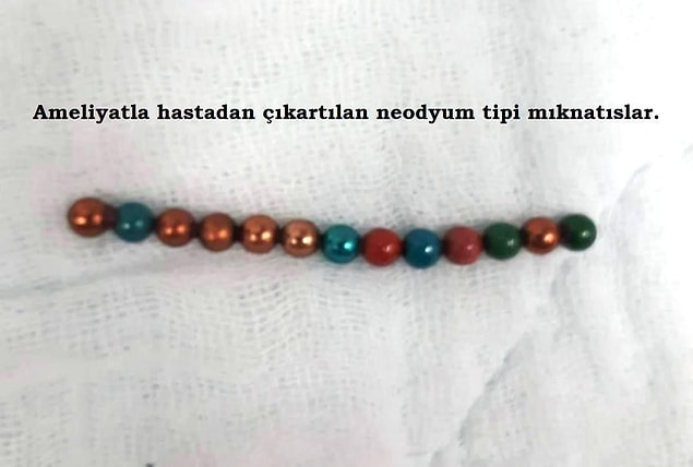 Minik Asya, 11 Şubatta taburcu edildi.