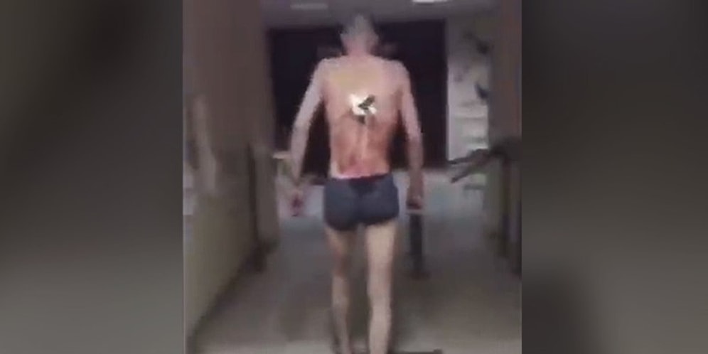Sırtına Saplanan Kocaman Bıçakla Kanlar İçerisinde Hastane Bahçesinde Sigara İçen Adam Görenleri Şok Etti!