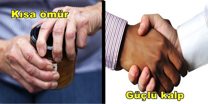 Elleriniz Size Sağlığınız ve Ömrünüzle İlgili Çok Şey Söylüyor Olabilir!