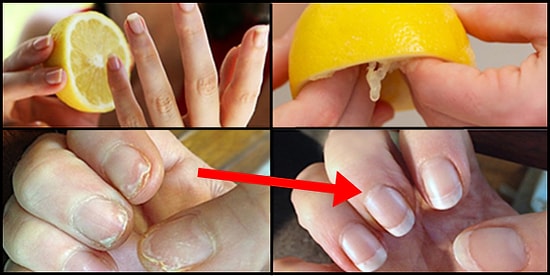 Yalnızca Limon Kullanarak Güzelliğine Güzellik Katabileceğini Biliyor muydun?