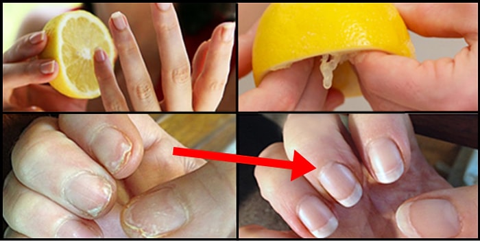 Yalnızca Limon Kullanarak Güzelliğine Güzellik Katabileceğini Biliyor muydun?