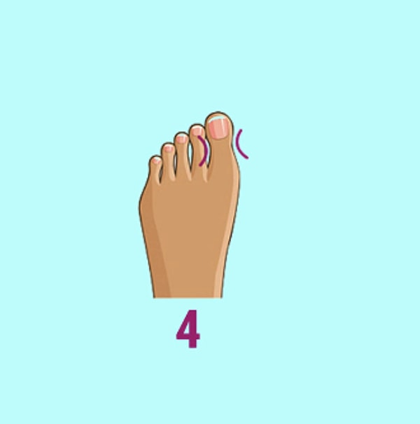 Большой палец в форме восьмерки: