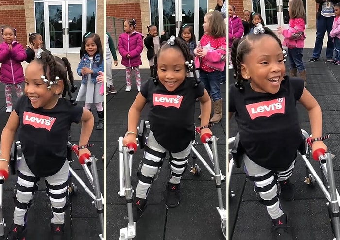 Doğuştan Sahip Olduğu Hastalığı Yüzünden Yürüyemeyen 4 Yaşındaki Çocuğun İlk Adımlarını Attığı Muhteşem Anlar!