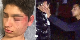 Sevgilisinin Eski Sevgilisinin Cebine 1 Lira Koyup Boks Makinesi Niyetine Döven Genç
