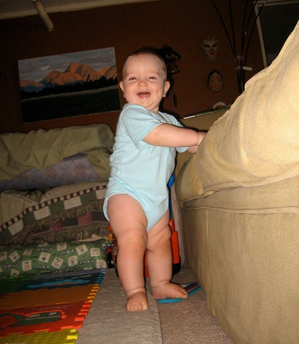 10. Человек рождается без коленных чашечек. Они развиваются к трехлетнему возрасту ребенка