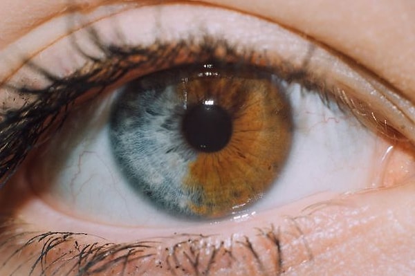 3. Такая же ситуация