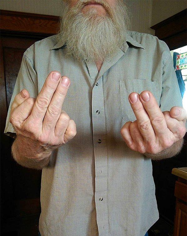 3. "Babamın her iki elinde de altı parmağı var. Birine hareket çekerken iki parmağını birden kullanıyor."