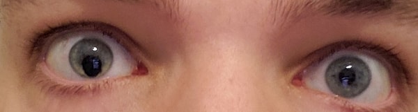 26. Вы видите этот зрачок?