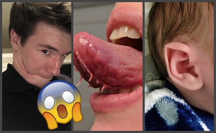 27 человек с уникальными и редкими особенностями тела