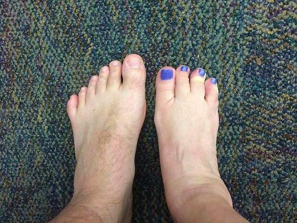 21. "I Was Born With 6 Toes On My Left Foot And My Co-Worker Was Born With 4 Toes On Her Right Foot"